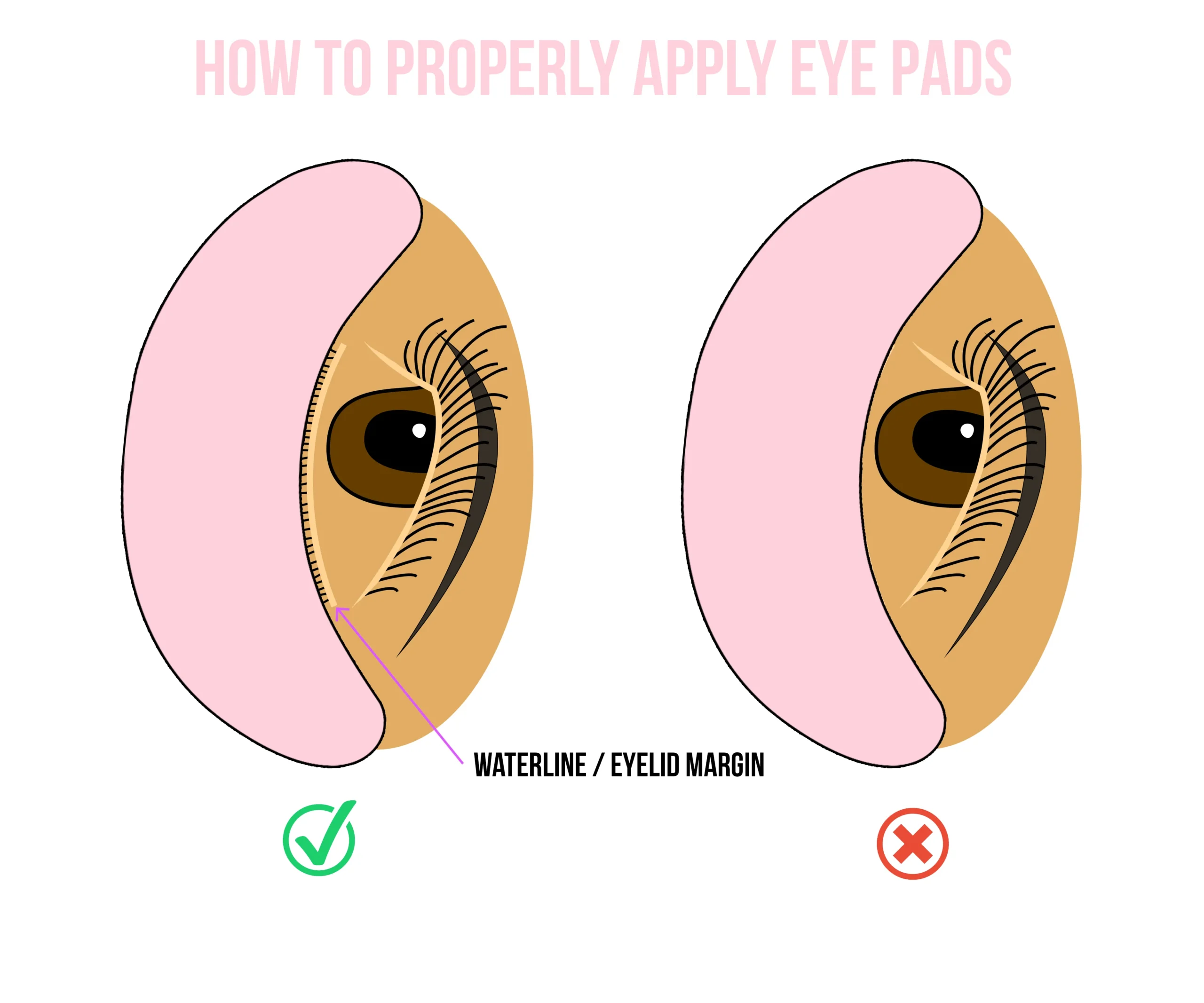 Eye Patches Correctly